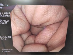 上部消化管汎用ビデオスコープ｜GIF-Q260｜オリンパスメディカルシステムズ株式会社の写真9枚目