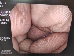 大腸ビデオスコープ｜PCF-Q260AI｜オリンパスメディカルシステムズ株式会社の写真9枚目
