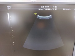4D超音波診断装置（カラードプラ）｜Voluson E6｜GEヘルスケアの写真9枚目