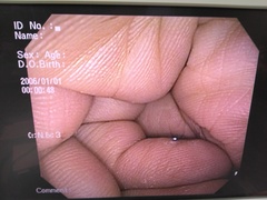 大腸ビデオスコープ｜CF-Q140I｜オリンパスメディカルシステムズ株式会社の写真9枚目