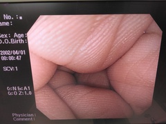Video Gastroscope｜GIF-H260Z｜Olympus Medical Systems photo8