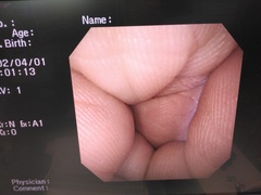 上部消化管汎用ビデオスコープ｜GIF-XP260NS｜オリンパスメディカルシステムズ株式会社の写真8枚目