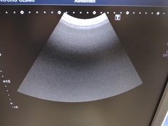 超音波診断装置（カラードプラ）｜Xario100 TUS-X100｜キヤノンメディカルシステムズの写真9枚目