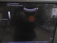Ultrasound system(Color)｜LOGIQ P5｜GE Healthcare photo9
