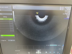 4D超音波診断装置（カラードプラ）｜Voluson P8｜GEヘルスケアの写真9枚目