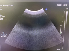 超音波診断装置｜Affiniti 50G｜フィリップスの写真9枚目