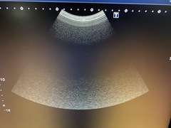 Ultrasound System(Color)｜Xario100 TUS-X100｜Canon Medical Systems photo9