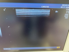Ultrasound system(Color)｜SSA-580A Nemio XG｜Canon Medical Systems photo9