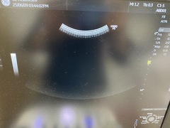 Ultrasound system(Color)｜LOGIQ P9｜GE Healthcare photo9
