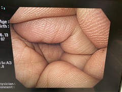 Video Gastroscope｜GIF-H260｜Olympus Medical Systems photo9