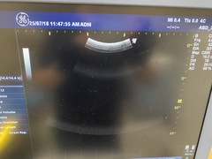 超音波診断装置（カラードプラ）｜LOGIQ P6｜GEヘルスケアの写真9枚目