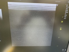 超音波診断装置（カラードプラ）｜LOGIQ P6｜GEヘルスケアの写真9枚目