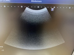 超音波診断装置（カラードプラ）｜XARIO 200 TUS‐X200｜キヤノンメディカルシステムズの写真9枚目