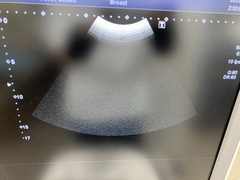 超音波診断装置（カラードプラ）｜Xario100 TUS-X100S｜キヤノンメディカルシステムズの写真9枚目
