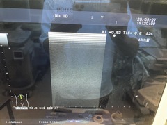 Ultrasound system(Color)｜Prosound α6｜Hitachi photo9