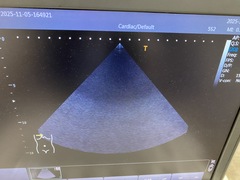 Ultrasound system｜Viamo α100　TUS-VC100｜Canon Medical Systems photo9