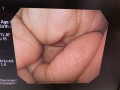 上部消化管汎用ビデオスコープ｜GIF-H260｜オリンパスメディカルシステムズ株式会社の写真9枚目