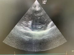 超音波診断装置｜LOGIQ S7 Expert｜GEヘルスケアの写真9枚目