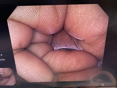 Video Gastroscope｜GIF-H290Z｜Olympus Medical Systems photo9