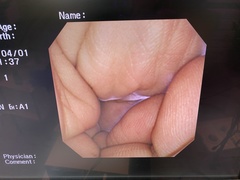 Video Gastroscope｜GIF-XP260｜Olympus Medical Systems photo9