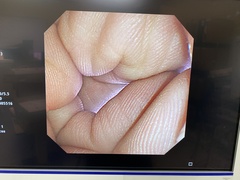 Video Transnasal Gastroscope｜GIF-XP260N｜Olympus Medical Systems photo9