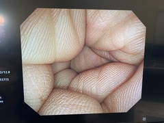 大腸ビデオスコープ｜CF-Q260AI｜オリンパスメディカルシステムズ株式会社の写真9枚目