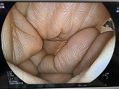 Video Transnasal Gastroscope｜EG-L580NW7｜Fujifilm Medical photo9