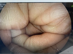 Video Gastroscope｜EG-3000FP｜Fujifilm Medical photo9