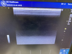 超音波診断装置｜LOGIQ e Premium｜GEヘルスケアの写真9枚目