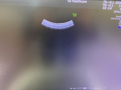 Ultrasound system(Color)｜Voluson E10｜GE Healthcare photo9