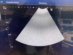 超音波診断装置｜Aplio 500 TUS-A500｜キヤノンメディカルシステムズの写真9枚目