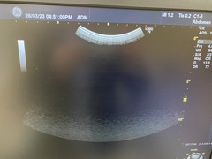 Ultrasound system(Color)｜LOGIQ P9｜GE Healthcare photo9