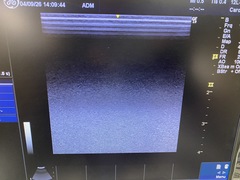 Ultrasound system(Color)｜LOGIQ e Expert｜GE Healthcare photo9