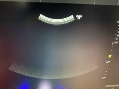 Ultrasound system(Color)｜LOGIQ P9 Pro｜GE Healthcare photo9