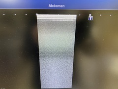 超音波診断装置(カラードプラ)ＬＣＤ｜Aplio 400 TUS-A400｜キヤノンメディカルシステムズの写真9枚目