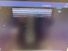 Ultrasound system(Color)｜SSA-580A Nemio XG｜Canon Medical Systems photo9