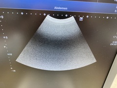 超音波診断装置（カラードプラ）｜XARIO 200 TUS‐X200｜キヤノンメディカルシステムズの写真9枚目