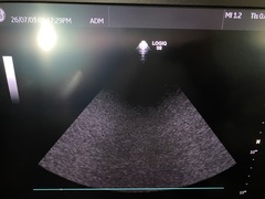 Ultrasound system(Color)｜LOGIQ S8 FS｜GE Healthcare photo6
