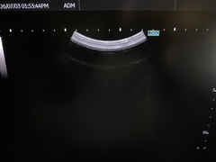 Ultrasound system(Color)｜LOGIQ Fortis｜GE Healthcare photo9