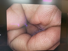 Video Gastroscope｜GIF-H290Z｜Olympus Medical Systems photo9