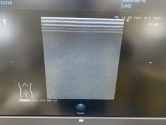 超音波診断装置｜ARIETTA 50｜富士フイルムメディカルの写真9枚目