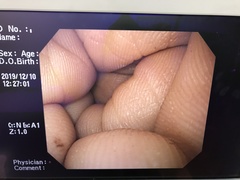 上部消化管汎用ビデオスコープ｜GIF-Q240｜オリンパスメディカルシステムズ株式会社の写真10枚目