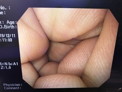 上部消化管汎用ビデオスコープ｜GIF-Q260｜オリンパスメディカルシステムズ株式会社の写真10枚目