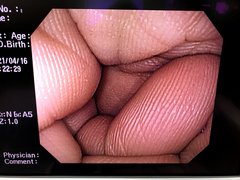 Video Colonoscope｜PCF-Q260JI｜Olympus Medical Systems photo10