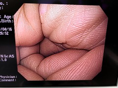 Video Gastroscope｜GIF-H260｜Olympus Medical Systems photo10