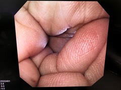 Video Gastroscope｜GIF-XQ260｜Olympus Medical Systems photo7