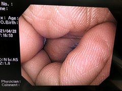 Video Gastroscope｜GIF-Q240X｜Olympus Medical Systems photo8