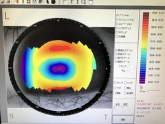 Corneal Topographer｜CT-1000｜Rexxam Co.,Ltd photo7