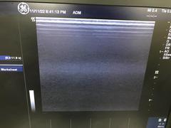 超音波診断装置（カラードプラ）｜LOGIQ e Expert｜GEヘルスケアの写真10枚目