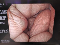 上部消化管汎用ビデオスコープ｜GIF-PQ260｜オリンパスメディカルシステムズ株式会社の写真10枚目